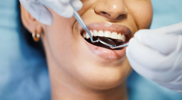 Best Emergency Tooth Extraction in Stevensville, MD