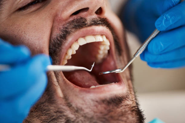 Best Emergency Treatment for Dental Infections or Abscesses in Stevensville, MD
